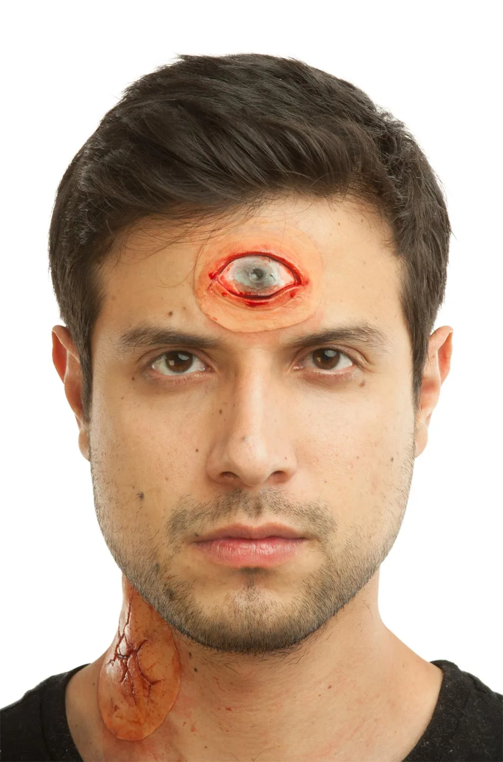 Sees Me Prosthetic 3 Sees Me Prosthetic