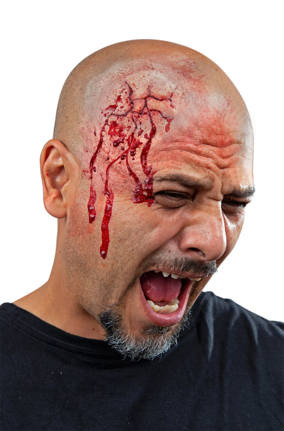 Cracked Prosthetic 3 Cracked Prosthetic